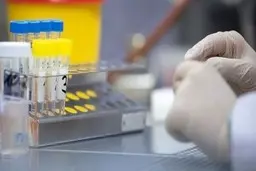 ارز| ارز ۴۲۰۰ تومانی و صنعت دارو