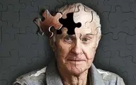 داروی درمان بیماری آلزایمر کشف شد!