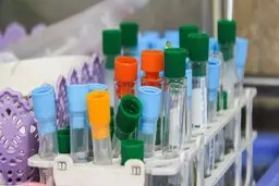 ثبت یک هزار مبتلا به کرونا در یک استان 