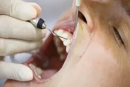 چرا وقتی از خواب بیدار می شویم بوی بد در دهان احساس می کنیم؟