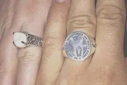 عجیب ترین حلقه دنیا با استفاده از دندان عقل شوهر! + عکس