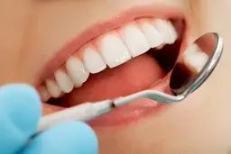 درخواست تفسیر قانون دندانسازی ۱۳۶۶ و تعیین تکلیف وضعیت شاغلان تجربی این حرفه