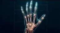  کشف اسرار نهفته | تکنولوژی اشعه ایکس در خدمت هنر +ویدئو