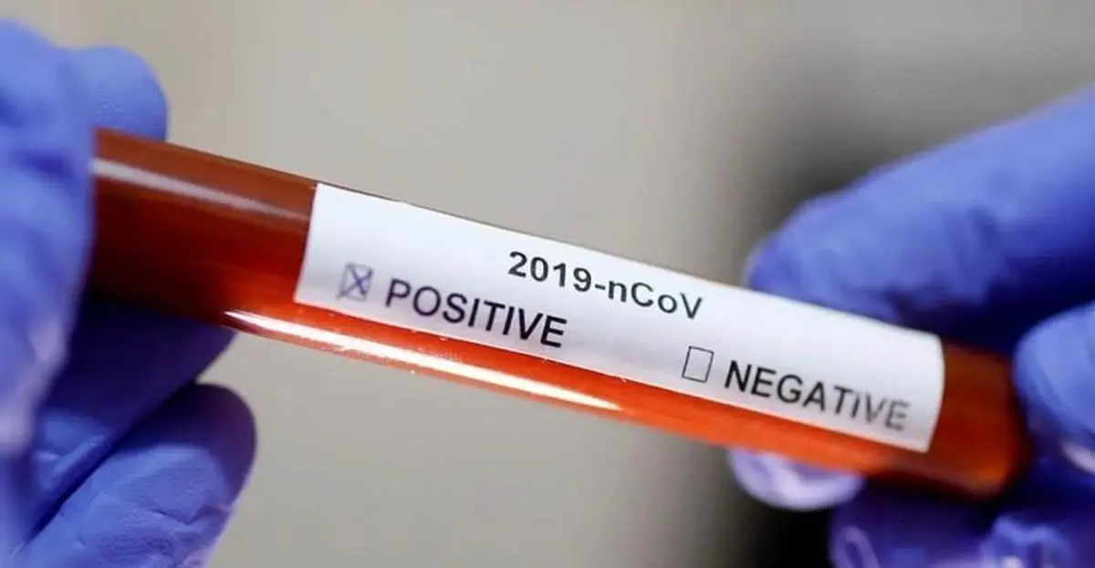 تست PCR کرونا تا چه زمانی مثبت می‌ماند؟