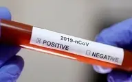 تست PCR کرونا تا چه زمانی مثبت می‌ماند؟