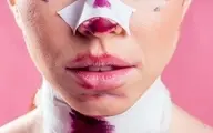 باز هم عمل زیبایی حادثه آفرید | مرگ تلخ زن جوان به‌خاطر عمل زیبایی