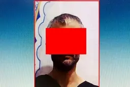 قتل | پسر گلو گوش و انگشتان پدرش را برید 