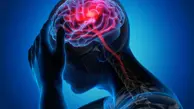 چند شرط اساسی برای درمان سکته مغزی