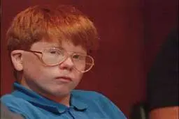 چرا مو قرمز ها کمتر درد را حس می کنند؟ 