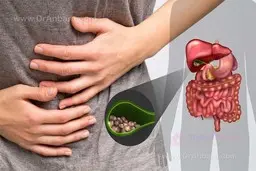 علائم ودرمان سنگ کیسه صفرا | چرا به سنگ کیسه صفرا مبتلا میشویم
