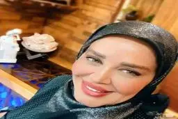 عکس جدید بهاره رهنما همه را شوکه کرد! |  بهاره رهنما را بعد از تزریقات متعدد ببینید!