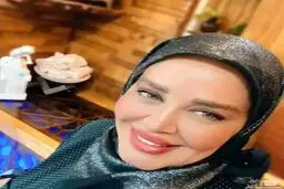 عکس جدید بهاره رهنما همه را شوکه کرد! |  بهاره رهنما را بعد از تزریقات متعدد ببینید!