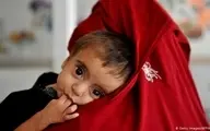 نیمی از کودکان زیر ۵ سال افغانستان سوءتغذیه دارند