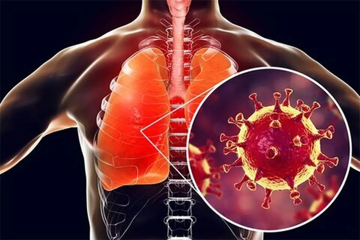  بیماران مبتلا |نحوه مراقبت از بیماران مبتلا به کووید -۱۹ خفیف در منزل ؟