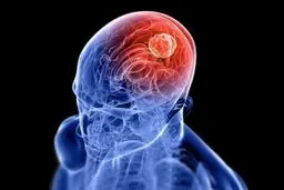 مغز انسان هر شب سم زدایی می‌کند!