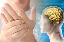انواع بیماری ام اس وتاثیر کرونا بر آن ها