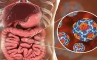 شوک بزرگ وبا به ایران | شناسایی قطعی چند بیمار مبتلا به وبا در کشور