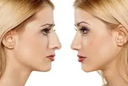 با این ماساژ دیگه لازم نیست بینی عمل کنی | سر بالا شدن بینی با این ماساژ | نحوه ماساژ دادن بینی برای تغییر فرم +ویدئو