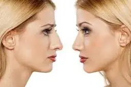 با این ماساژ دیگه لازم نیست بینی عمل کنی | سر بالا شدن بینی با این ماساژ | نحوه ماساژ دادن بینی برای تغییر فرم +ویدئو