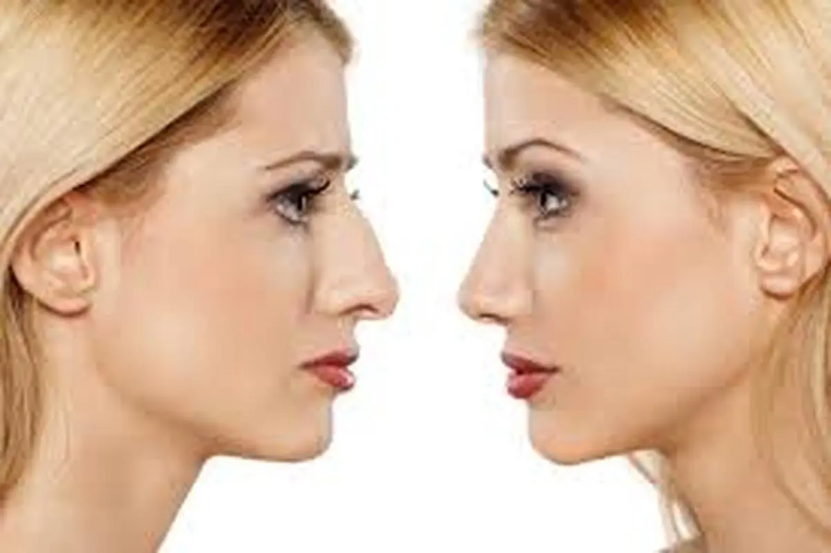 خطرات عمل بینی +ویدئو