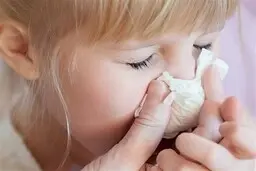 افزایش شیوع آنفلوآنزا تا دو ماه آینده | مراقب ابتلا همزمان آنفلوآنزا و کرونا باشید