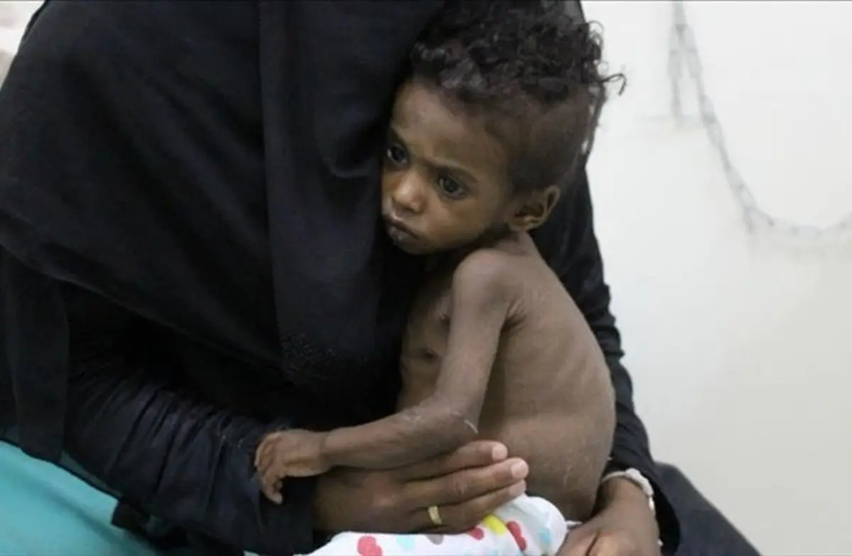 تروریست انصارالله  |  خانواده‌های یمنی از کمبود شدید موادغذایی بیمناک هستند.
