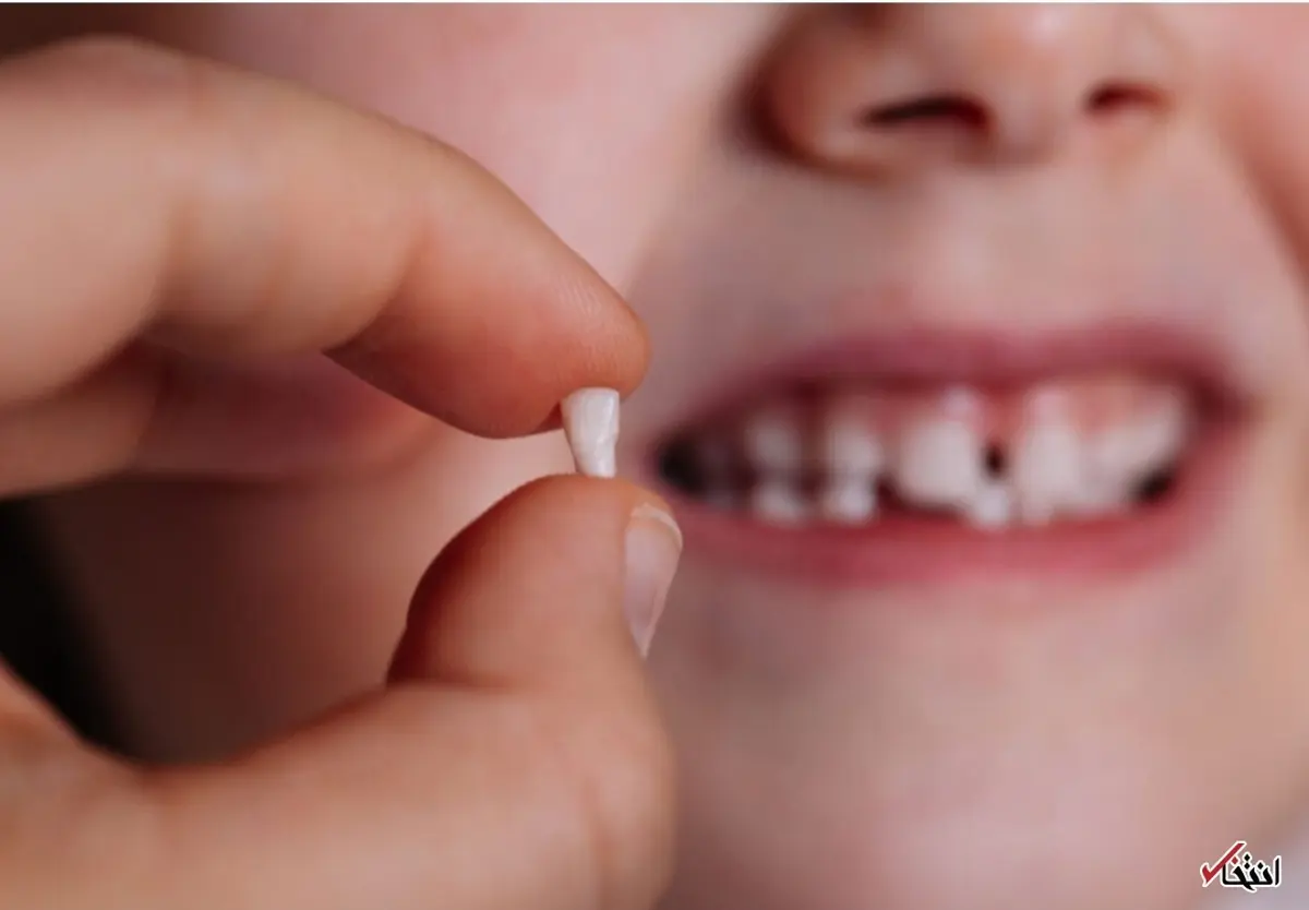 کشف اختلالات روانی با کمک دندان‌های شیری