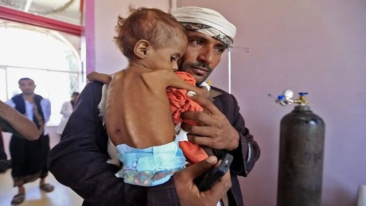 برنامه جهانی غذا اقدام فوری برای پایان گرسنگی در یمن را خواستار شد