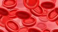 
علائم احتمالی لخته خون در بدن را بشناسید
