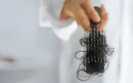 این غذاها باعث ریزش مو می‌شوند | اگر این غذاهارو بخوری ریشه موهات تضعیف میشه