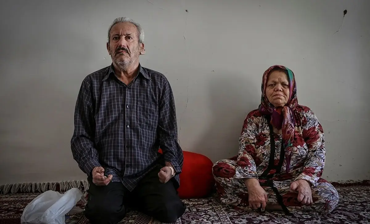 بیماری جذام  | حل مشکلات ۴۰ ساله جذامیان در مشهد  + عکس