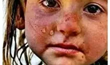 به یاد دخترکان زیباروی ایران زمین | و اینک جهان اشک می ریزد