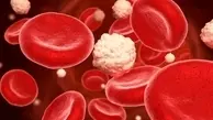 چگونه چربی خون را به راحتی کاهش دهیم؟! | طب ایرانی مدرن