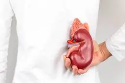  ۵ روش برای درمان خانگی سنگ کلیه 