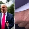 ترامپ با چهره‌ای متفاوت در مراسم ۱۱ سپتامبر | آیا ترامپ سکته کرده؟