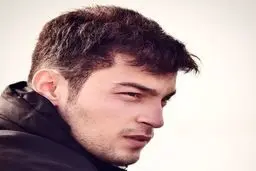 تغییر چهره عجیب بازیگر سریال «زخم کاری»+ عکس 