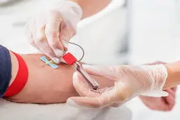  نکاتی که رعایت آن‌ها در حین اهدای خون توصیه می‌شود