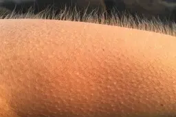  مورمور شدن و چندحقایق جالب درباره این واکنش عجیب 