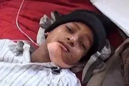 پسری-با-80-دندان-اضافه درداخل فک+ عکس 