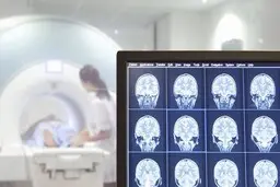 کشف جالب در مورد مغز جنایتکاران  | مغز تبهکاران بزرگ‌تر است؟