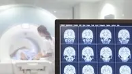 کشف جالب در مورد مغز جنایتکاران  | مغز تبهکاران بزرگ‌تر است؟