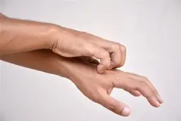 جدیدترین نشانه ابتلا به ویروس کرونا؛ خارش پوست می باشد