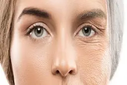 چرا زنان زودتر از مردان پیر می‌شوند ؟