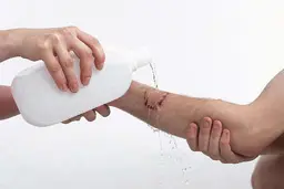 ترمیم زخم های  روی پوست چگونه است؟