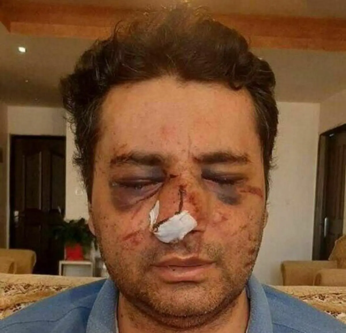 ضرب و شتم پزشک | تصویری پر از درد