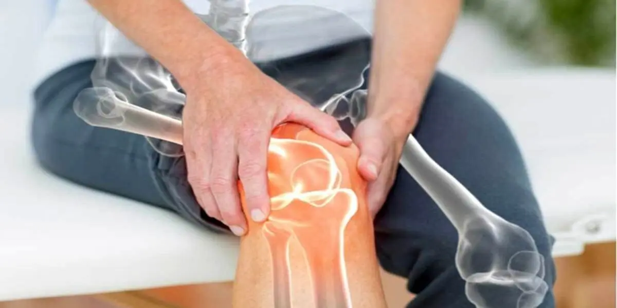 
 ترکیب گیاهی مفید برای درمان  آرتروز زانو 
