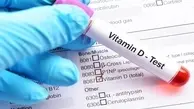 علایم کمبود ویتامین D در بدن 