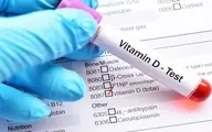 علایم کمبود ویتامین D در بدن 