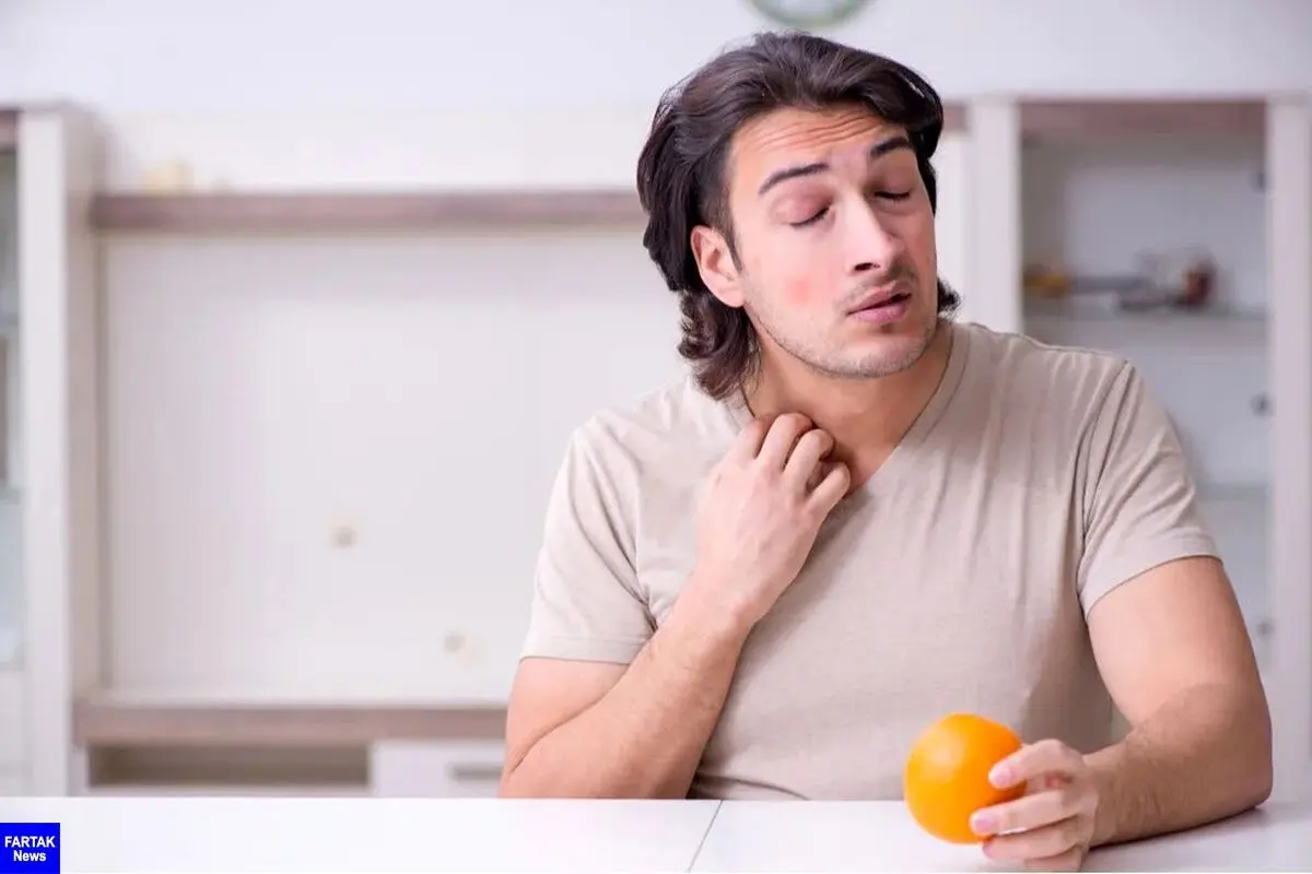 آیا به مرکبات آلرژی دارید؟ | آشنایی با علائم آلرژی به مرکبات!