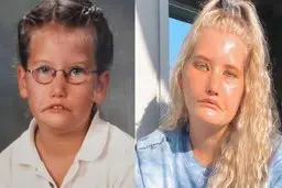 زنی که تابه حال نخندیده است | بیماری عجیبی که نمی گذارد بخندید